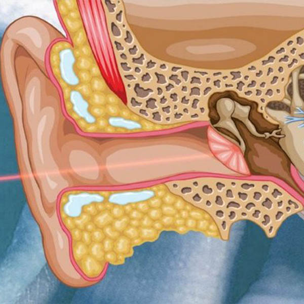 Otologie